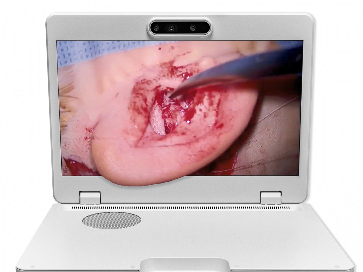 达擎之＂Heads-up 3D显微手术显示系统＂，整合4K裸眼3D显示及眼球追踪系统，具备快速追踪人眼移动位置功能，减轻医师长时间维持固定姿势的负担，让医师能有更宽广清晰的3D立体视野及更舒适的姿势来执行手术。